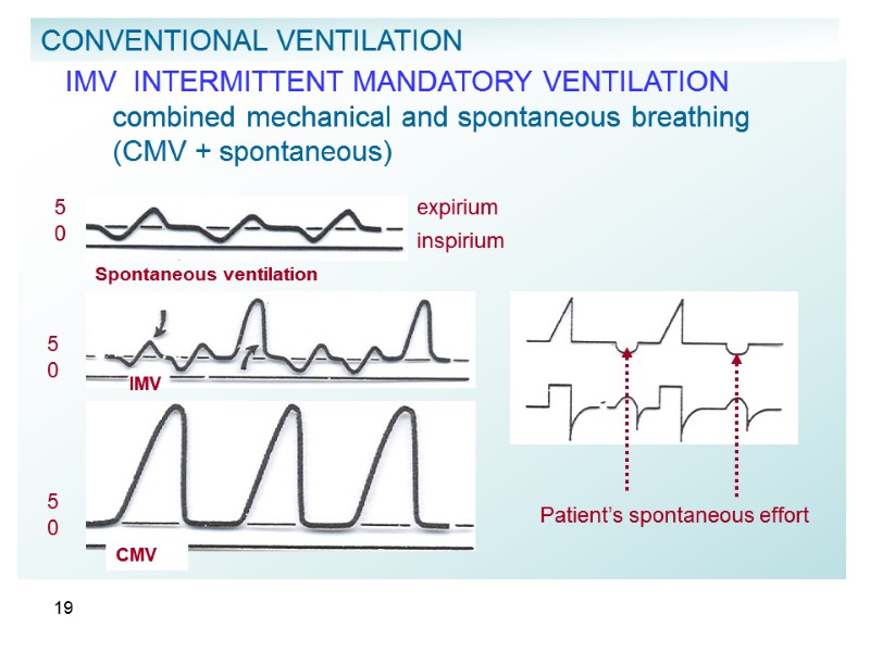 19      IMV  INTERMITTENT MANDATORY VENTILATION   combined